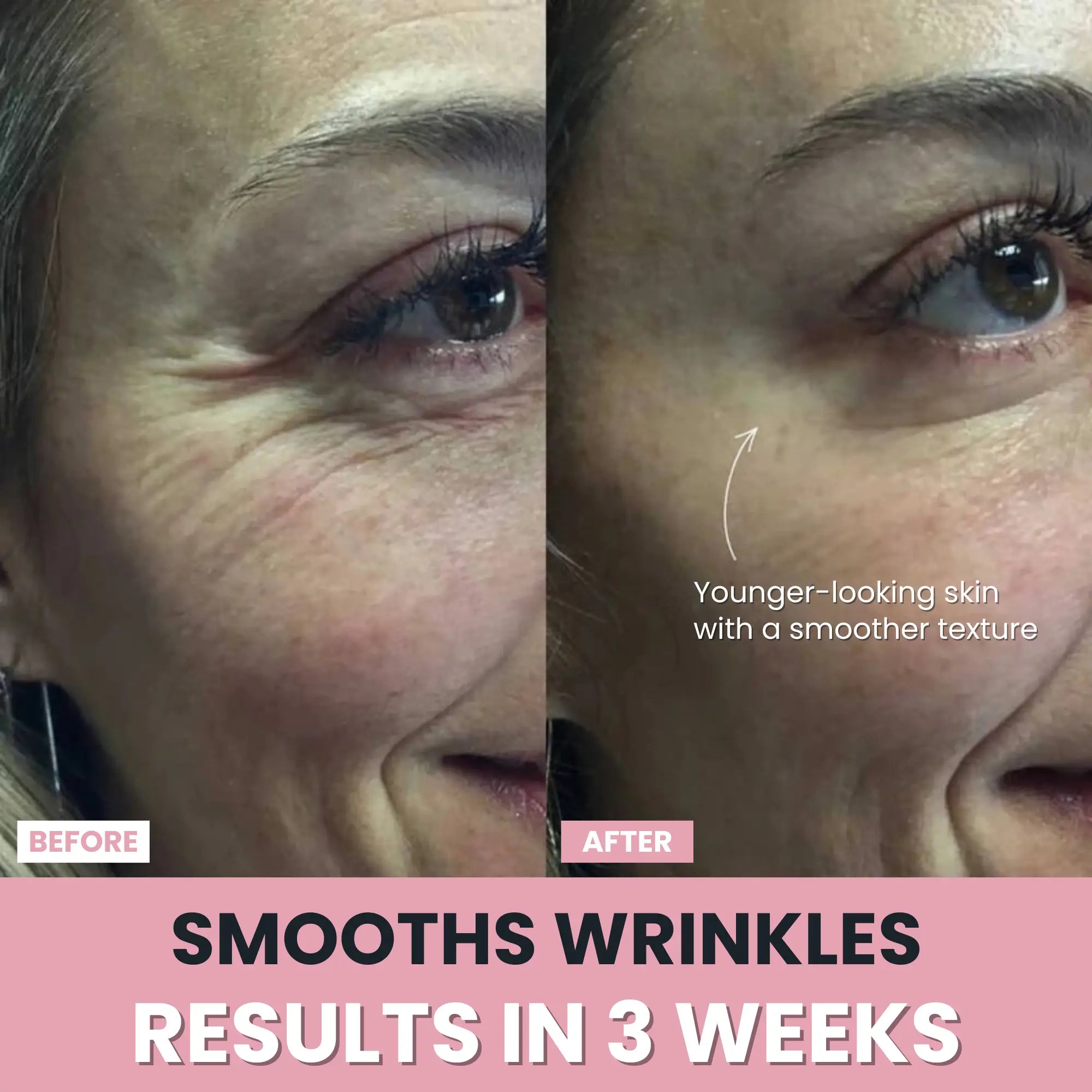 LenaSilk™ — 7-in-1 LED Facial Sculptor
