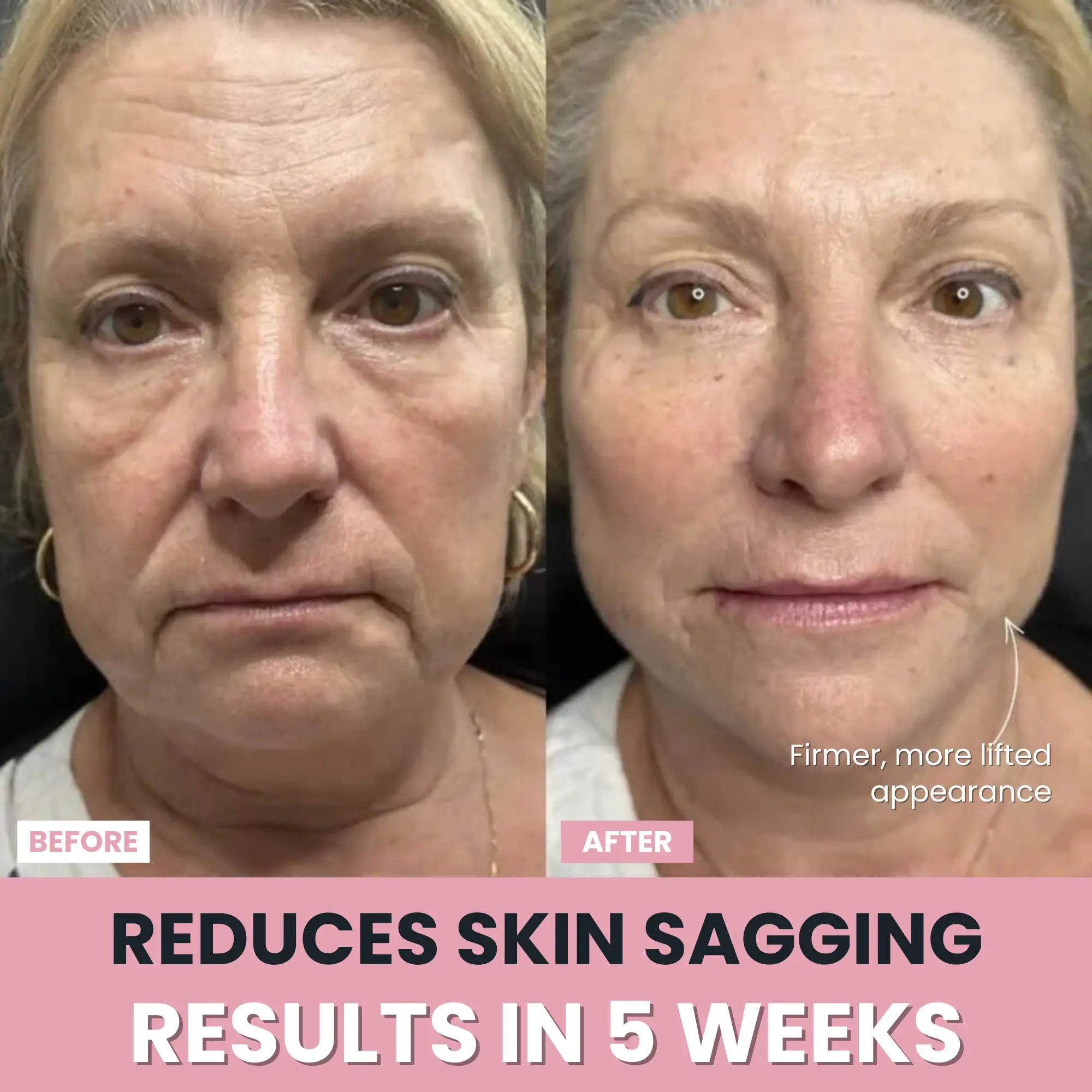 LenaSilk™ — 7-in-1 LED Facial Sculptor