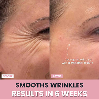 LenaSilk™ — 7-in-1 LED Facial Sculptor