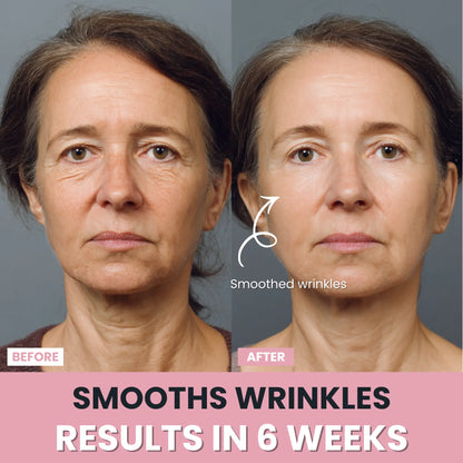 LenaSilk™ — 7-in-1 LED Facial Sculptor