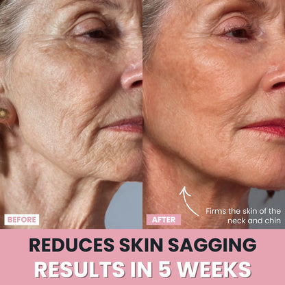LenaSilk™ — 7-in-1 LED Facial Sculptor