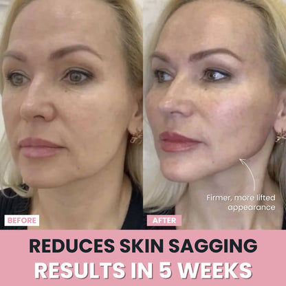 LenaSilk™ — 7-in-1 LED Facial Sculptor
