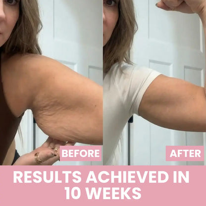 LenaSilk™ — 7-in-1 LED Arm Sculptor
