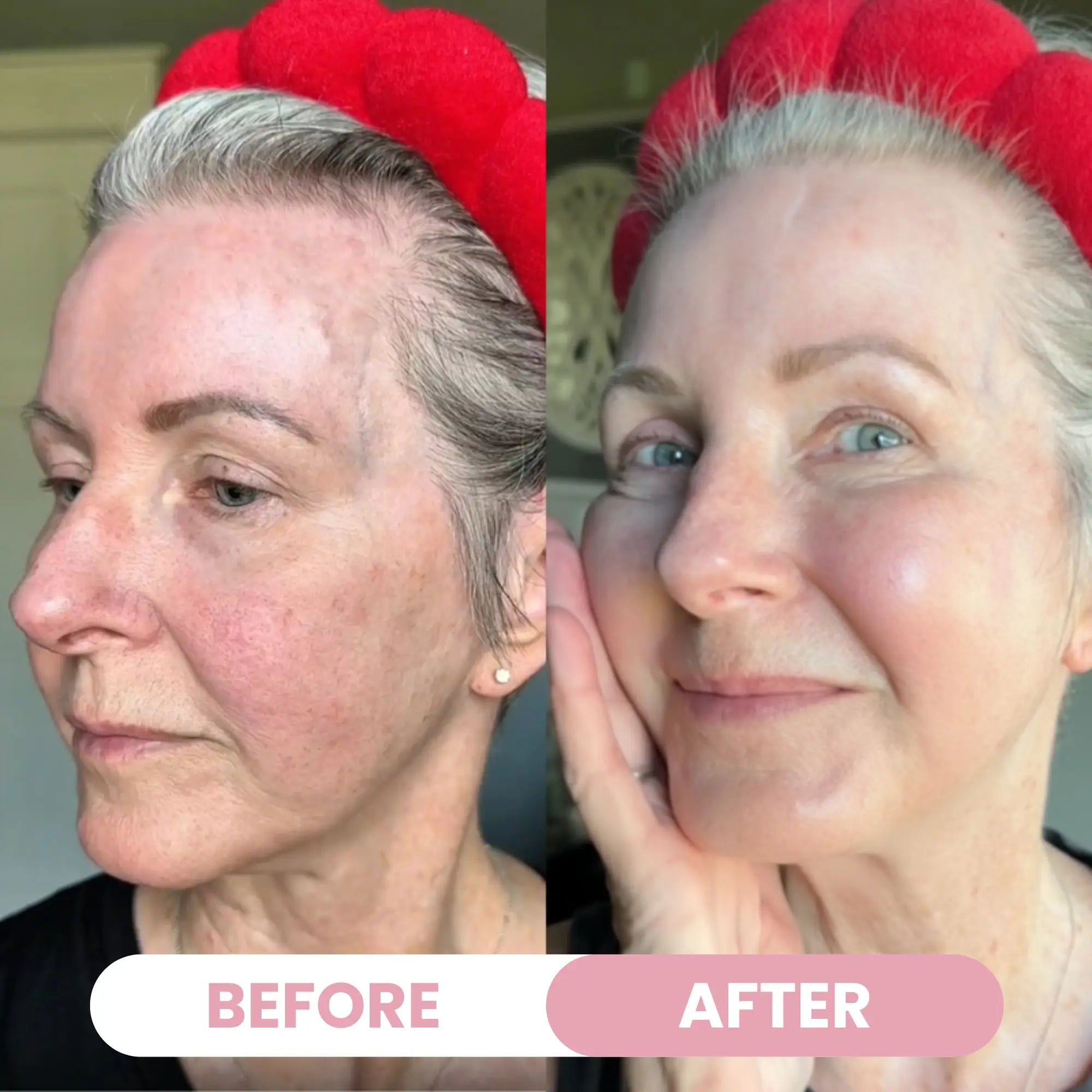 Bio-Collagen Mask