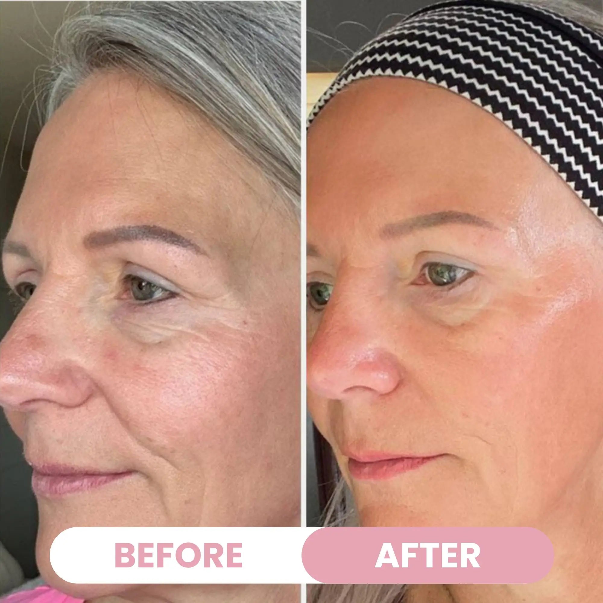Bio-Collagen Mask